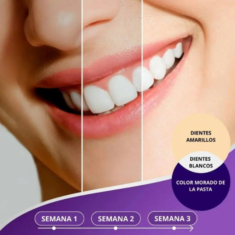 Blanqueador Dental Morada v34